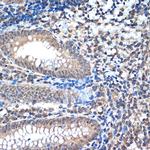 RCOR1 Antibody in Immunohistochemistry (Paraffin) (IHC (P))