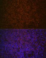 SHIP1 Antibody in Immunohistochemistry (Paraffin) (IHC (P))