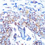 HDAC6 Antibody in Immunohistochemistry (Paraffin) (IHC (P))