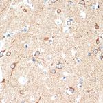 CD264 (TRAIL-R4) Antibody in Immunohistochemistry (Paraffin) (IHC (P))