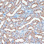 CD264 (TRAIL-R4) Antibody in Immunohistochemistry (Paraffin) (IHC (P))