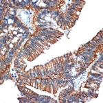 A33 Antibody in Immunohistochemistry (Paraffin) (IHC (P))