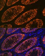 A33 Antibody in Immunohistochemistry (Paraffin) (IHC (P))