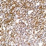 CD35 Antibody in Immunohistochemistry (Paraffin) (IHC (P))