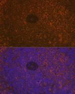 CD35 Antibody in Immunohistochemistry (Paraffin) (IHC (P))