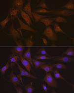 LIS1 Antibody in Immunocytochemistry (ICC/IF)