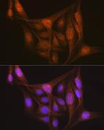 LIS1 Antibody in Immunocytochemistry (ICC/IF)