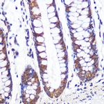 TCP1 Antibody in Immunohistochemistry (Paraffin) (IHC (P))