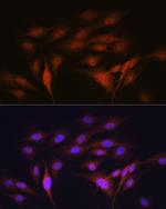 LXR alpha Antibody in Immunocytochemistry (ICC/IF)