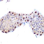 LXR alpha Antibody in Immunohistochemistry (Paraffin) (IHC (P))