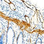 MYH11 Antibody in Immunohistochemistry (Paraffin) (IHC (P))