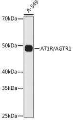 AGTR1 Antibody in Western Blot (WB)