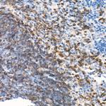 CD79b Antibody in Immunohistochemistry (Paraffin) (IHC (P))