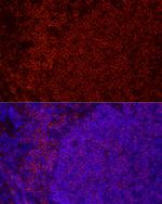 CD79b Antibody in Immunohistochemistry (Paraffin) (IHC (P))