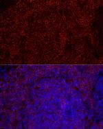 CD79b Antibody in Immunohistochemistry (Paraffin) (IHC (P))