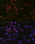 HAT1 Antibody in Immunocytochemistry (ICC/IF)