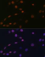 HAT1 Antibody in Immunocytochemistry (ICC/IF)