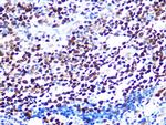 HAT1 Antibody in Immunohistochemistry (Paraffin) (IHC (P))