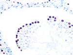 HAT1 Antibody in Immunohistochemistry (Paraffin) (IHC (P))