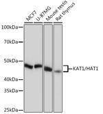 HAT1 Antibody in Western Blot (WB)