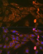 STAT4 Antibody in Immunocytochemistry (ICC/IF)