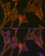 STAT4 Antibody in Immunocytochemistry (ICC/IF)