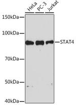 STAT4 Antibody in Western Blot (WB)