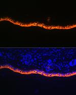 Cytokeratin 10 Antibody in Immunohistochemistry (Paraffin) (IHC (P))