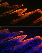 Cytokeratin 10 Antibody in Immunohistochemistry (Paraffin) (IHC (P))