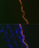 Cytokeratin 10 Antibody in Immunohistochemistry (Paraffin) (IHC (P))