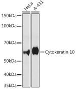 Cytokeratin 10 Antibody in Western Blot (WB)