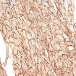 Caveolin 3 Antibody in Immunohistochemistry (Paraffin) (IHC (P))