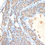 Cytochrome P450 Reductase Antibody in Immunohistochemistry (Paraffin) (IHC (P))