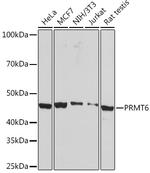 PRMT6 Antibody in Western Blot (WB)