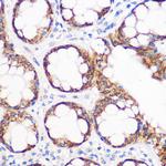 IGF2BP2 Antibody in Immunohistochemistry (Paraffin) (IHC (P))