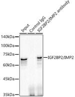 IGF2BP2 Antibody in Immunoprecipitation (IP)