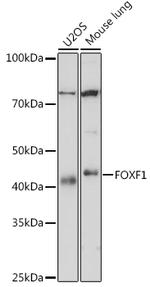 FOXF1 Antibody in Western Blot (WB)