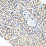 SPRY2 Antibody in Immunohistochemistry (Paraffin) (IHC (P))