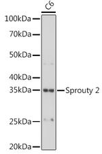 SPRY2 Antibody in Western Blot (WB)