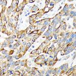 Cytokeratin 16 Antibody in Immunohistochemistry (Paraffin) (IHC (P))