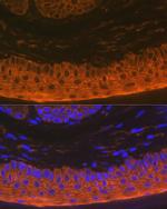 Cytokeratin 16 Antibody in Immunohistochemistry (Paraffin) (IHC (P))