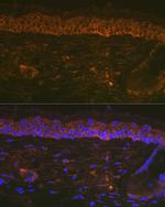 Cytokeratin 16 Antibody in Immunohistochemistry (Paraffin) (IHC (P))