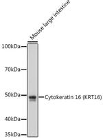 Cytokeratin 16 Antibody in Western Blot (WB)