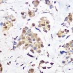 LSD1 Antibody in Immunohistochemistry (Paraffin) (IHC (P))