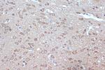 BAG2 Antibody in Immunohistochemistry (Paraffin) (IHC (P))