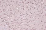 BAG2 Antibody in Immunohistochemistry (Paraffin) (IHC (P))