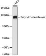 Butyrylcholinesterase Antibody in Western Blot (WB)