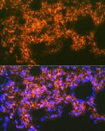 Mesothelin Antibody in Immunohistochemistry (Paraffin) (IHC (P))