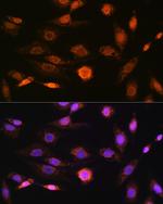 CaMKIV Antibody in Immunocytochemistry (ICC/IF)