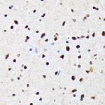 CaMKIV Antibody in Immunohistochemistry (Paraffin) (IHC (P))